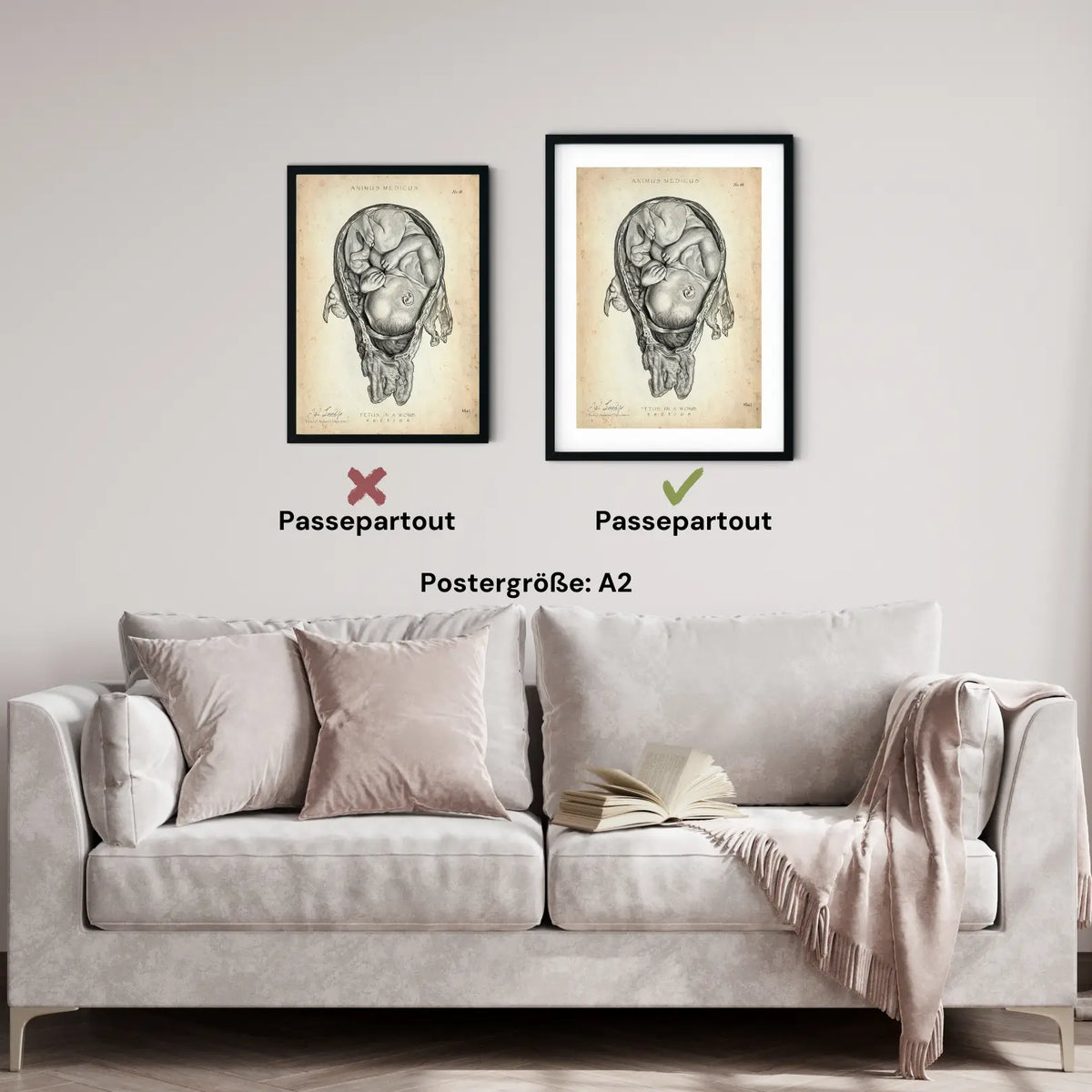 Baby in Gebärmutter - Animus Medicus GmbH