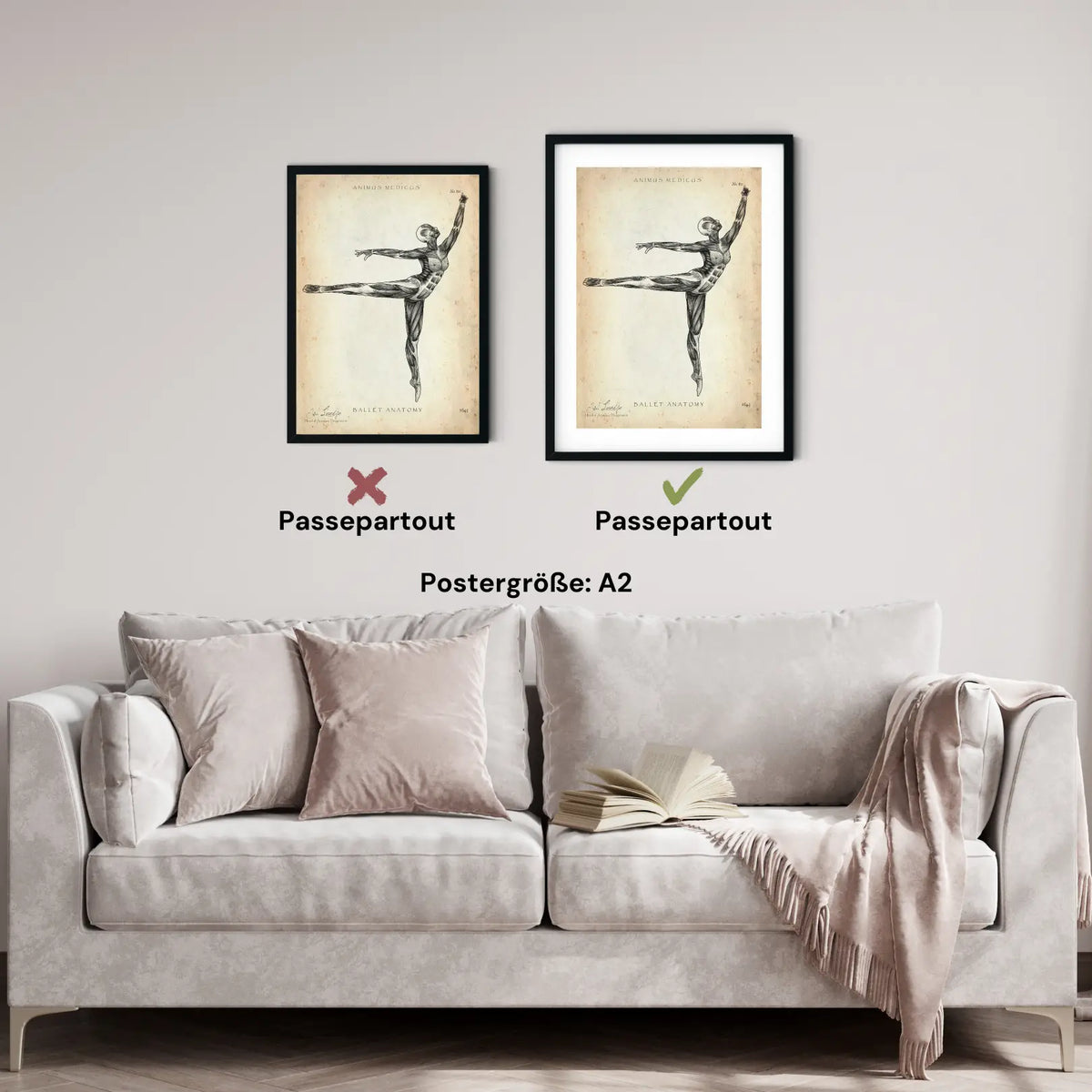 Ballett Anatomie Poster - Animus Medicus GmbH