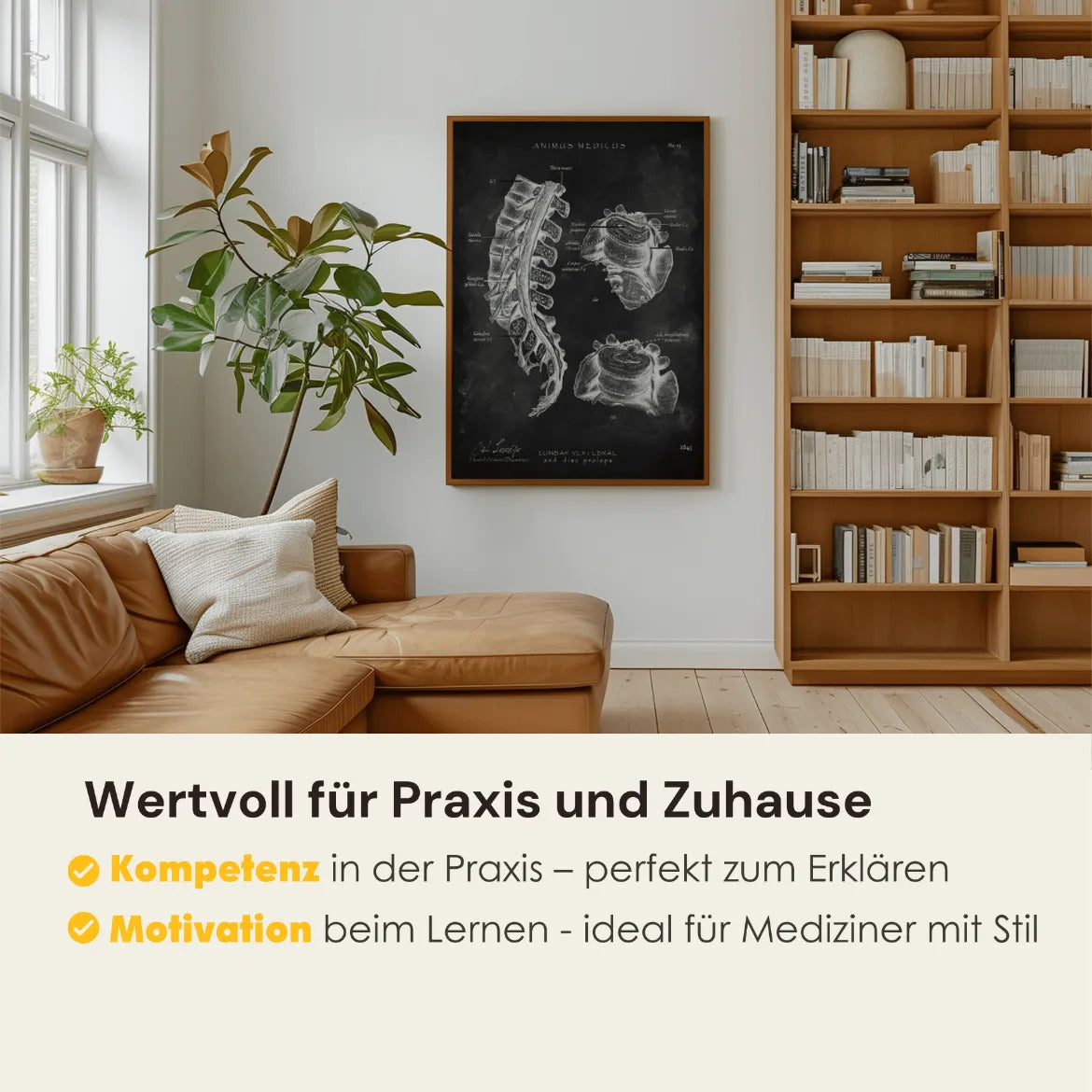 Bandscheibenvorfall Anatomie - Chalkboard - Animus Medicus GmbH