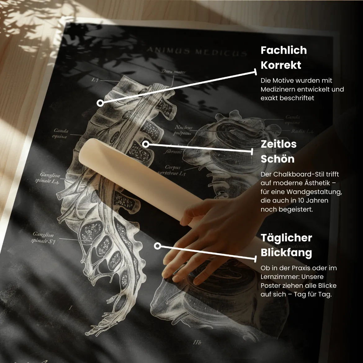 Bandscheibenvorfall Anatomie - Chalkboard - Animus Medicus GmbH