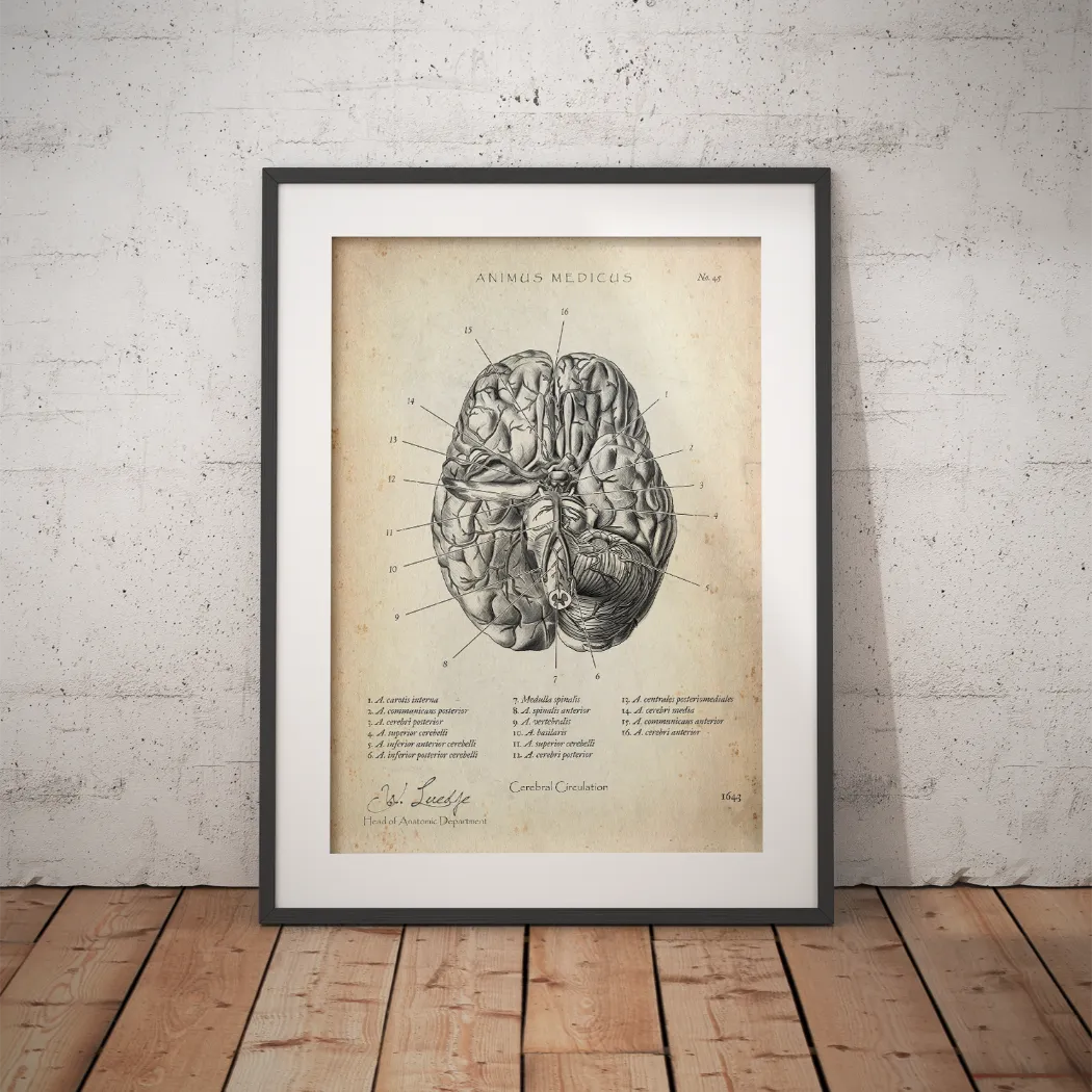 Circulus arteriosus willisii - Animus Medicus GmbH