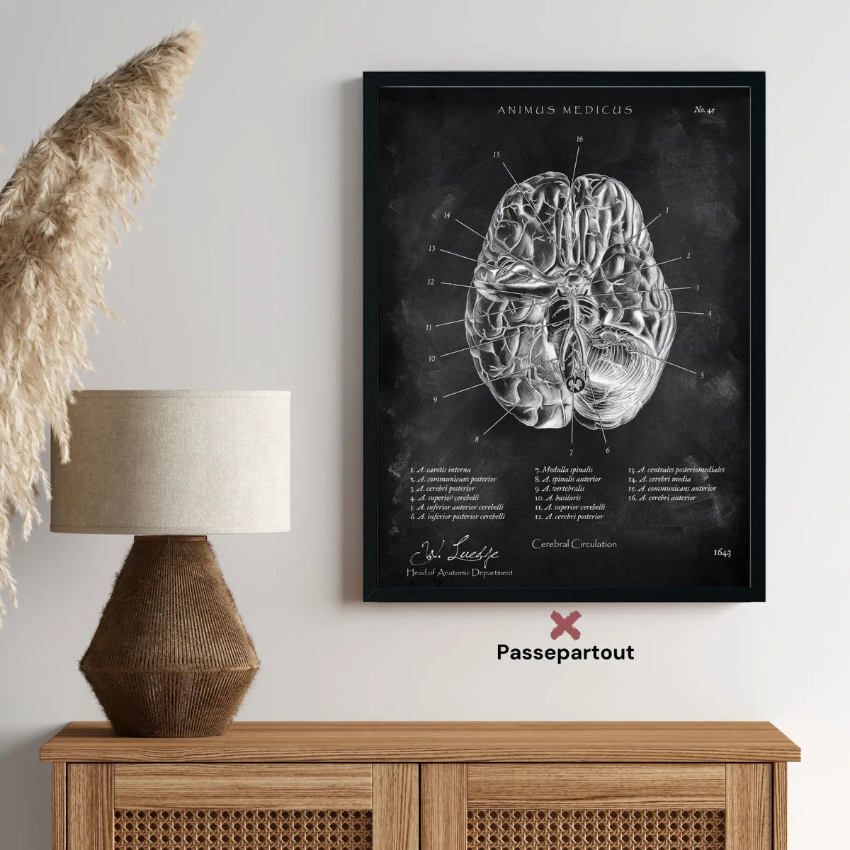 Circulus arteriosus willisii - Chalkboard - Animus Medicus GmbH