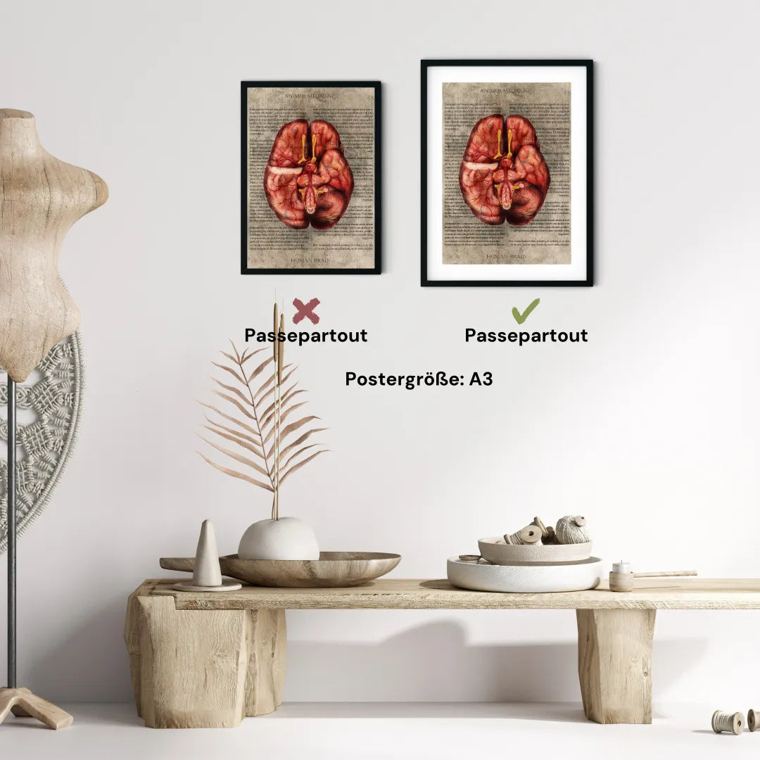 Das Gehirn - Buchseite - Animus Medicus GmbH