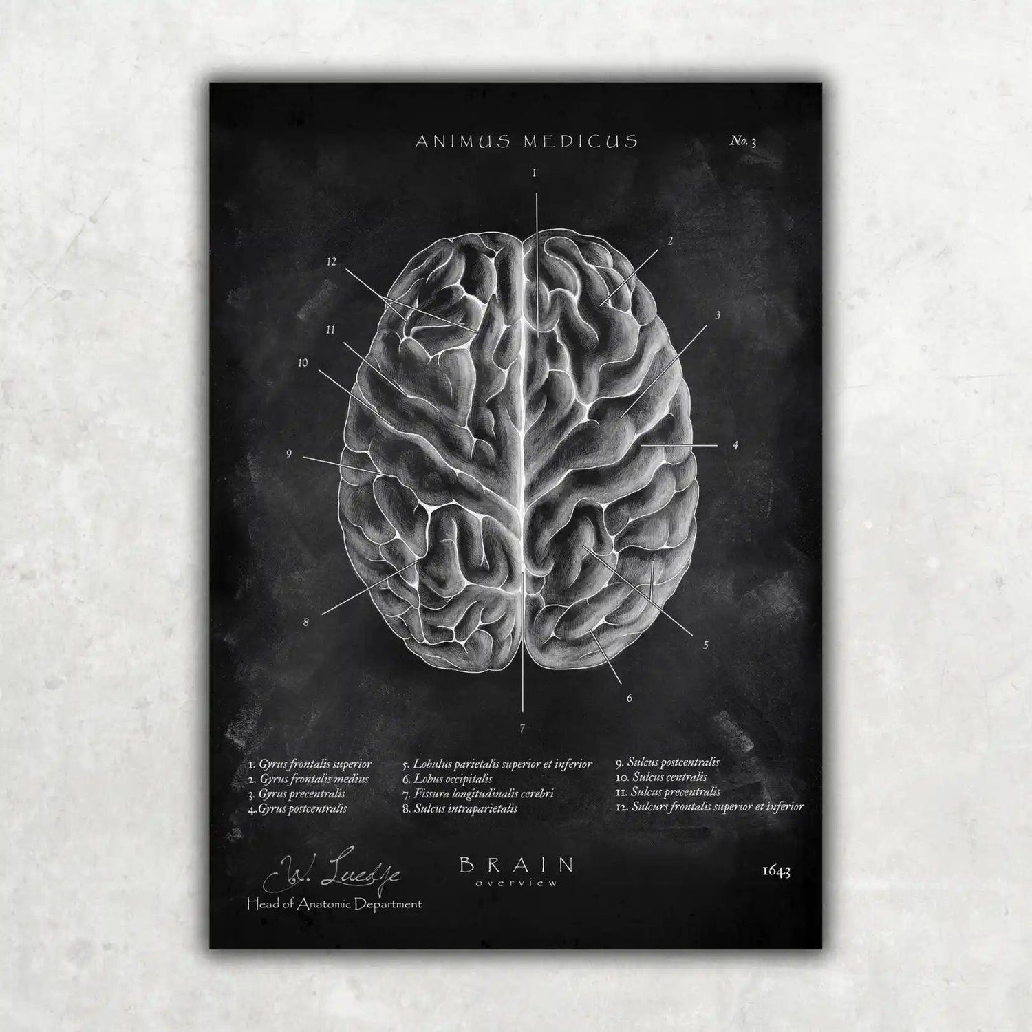 Das menschliche Gehirn - Chalkboard - Animus Medicus GmbH