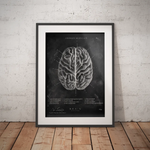 Das menschliche Gehirn - Chalkboard - Animus Medicus GmbH