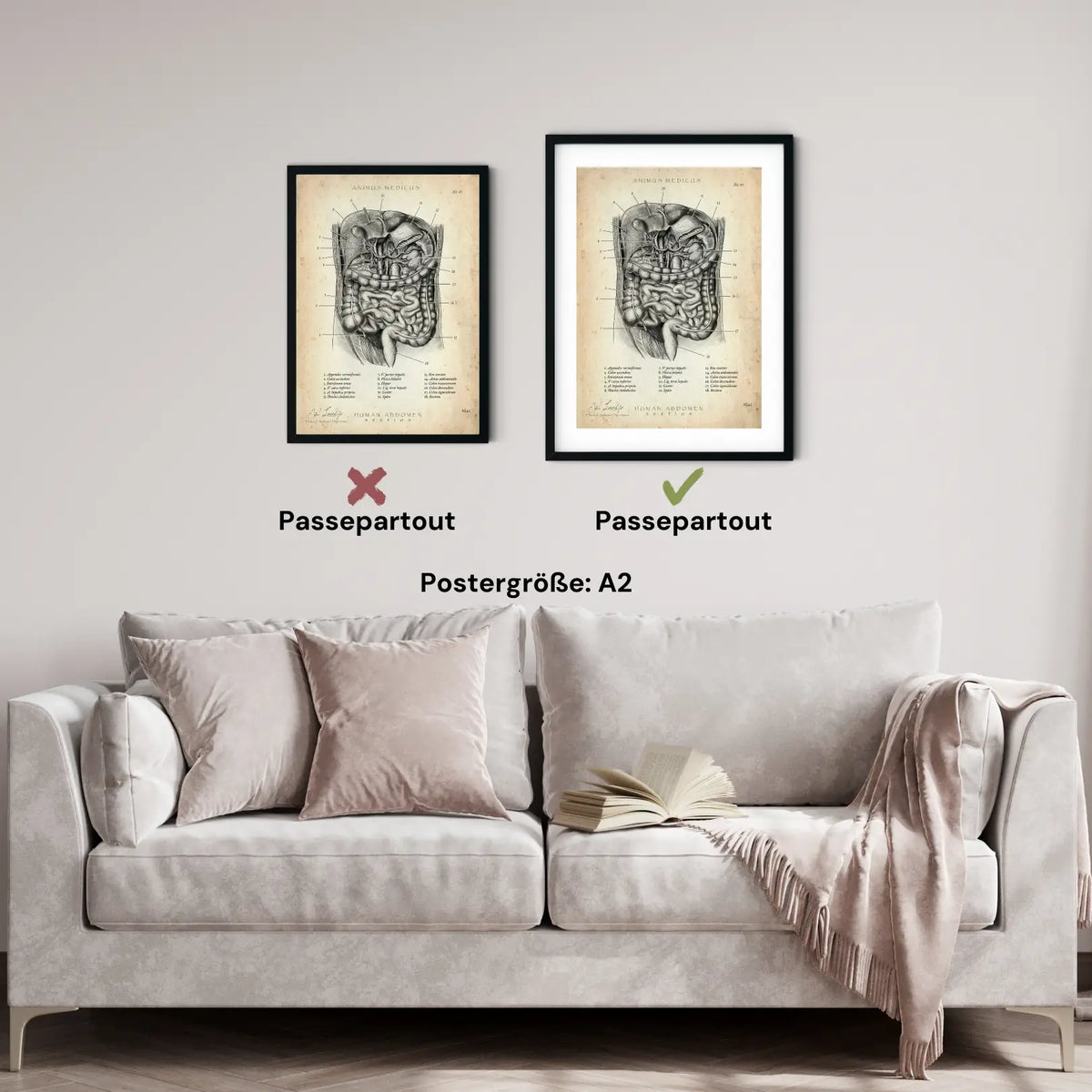 Der Bauch im Schnitt - Animus Medicus GmbH