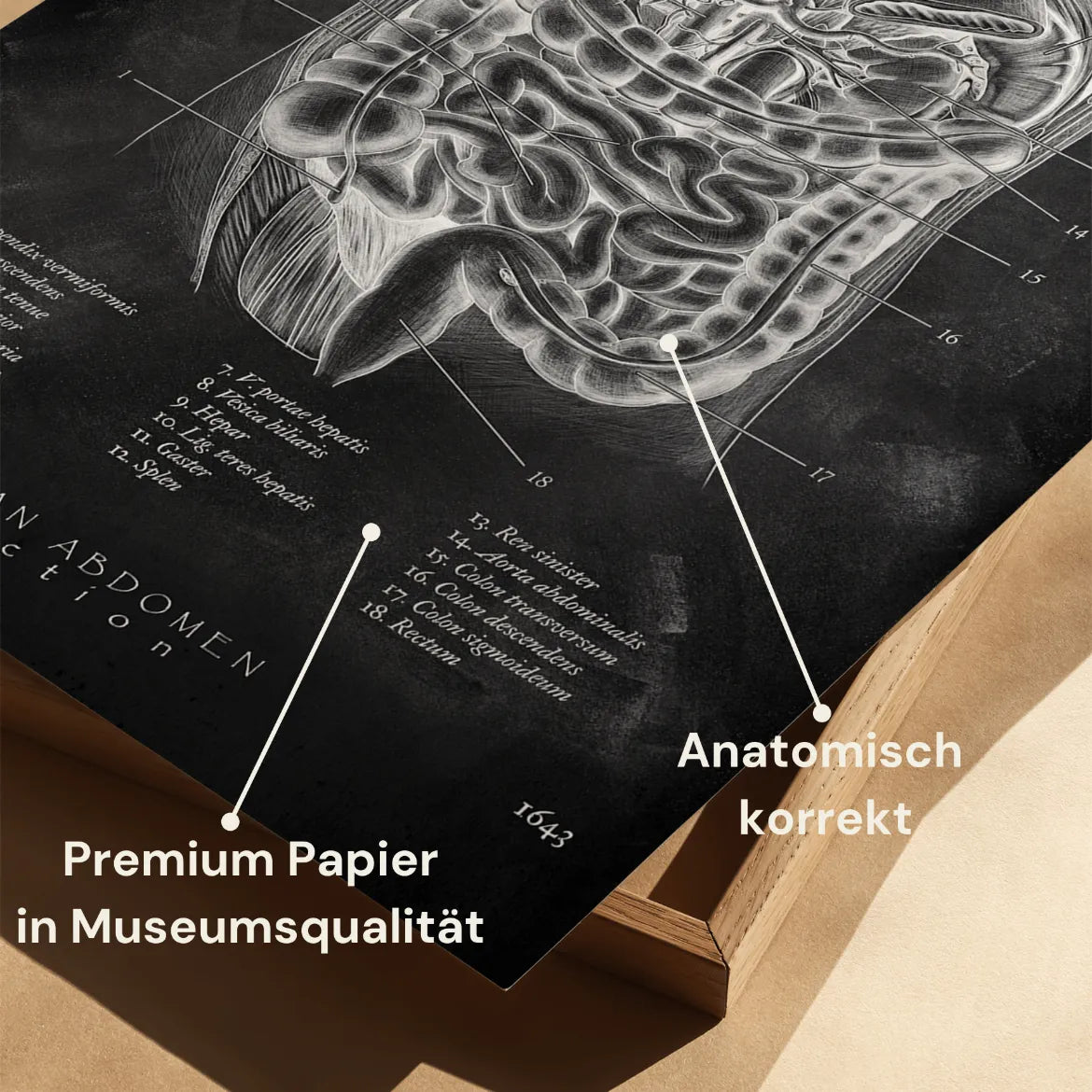 Der Bauch im Schnitt - Chalkboard - Animus Medicus GmbH