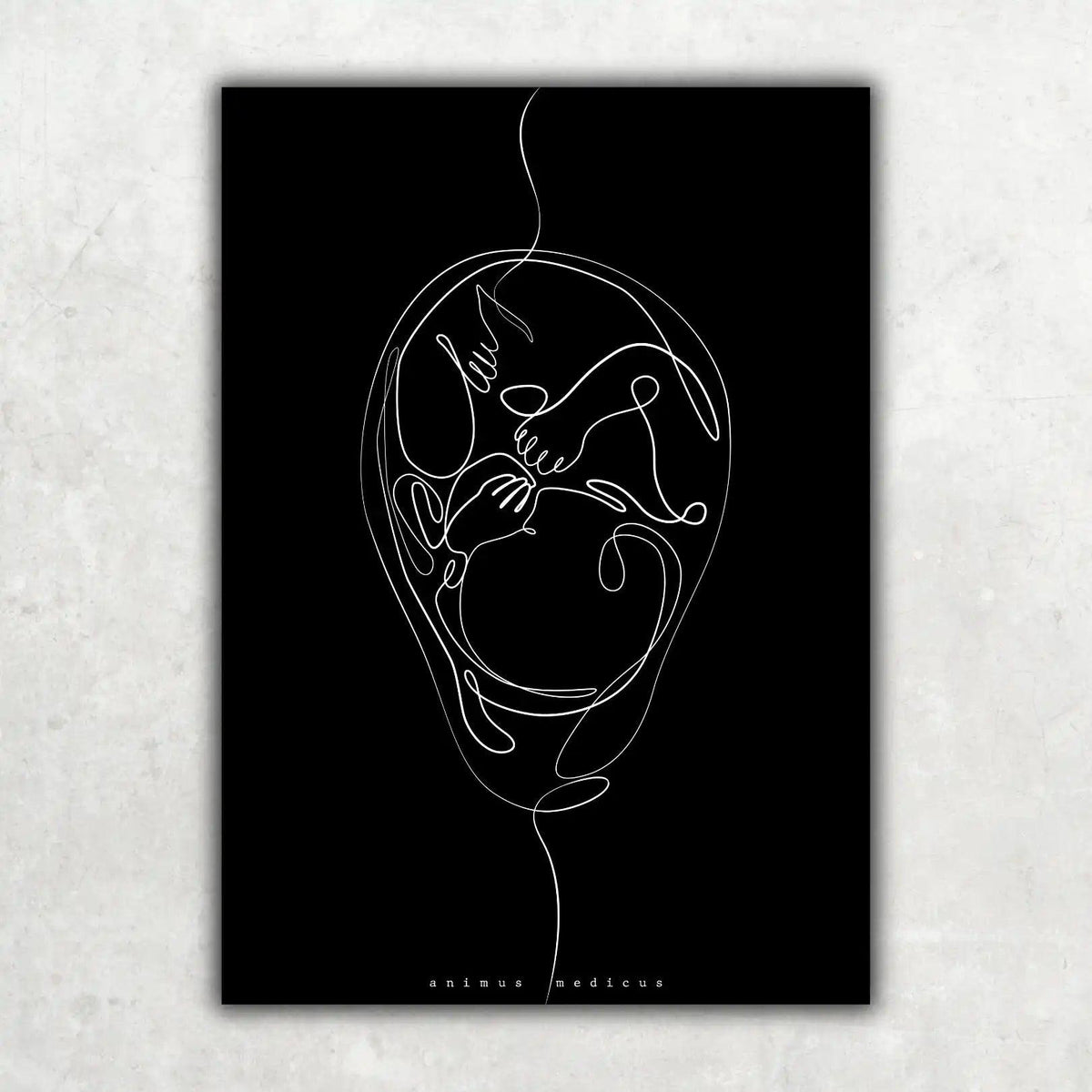 Fetus Anatomie Minimalist Dark - Animus Medicus GmbH