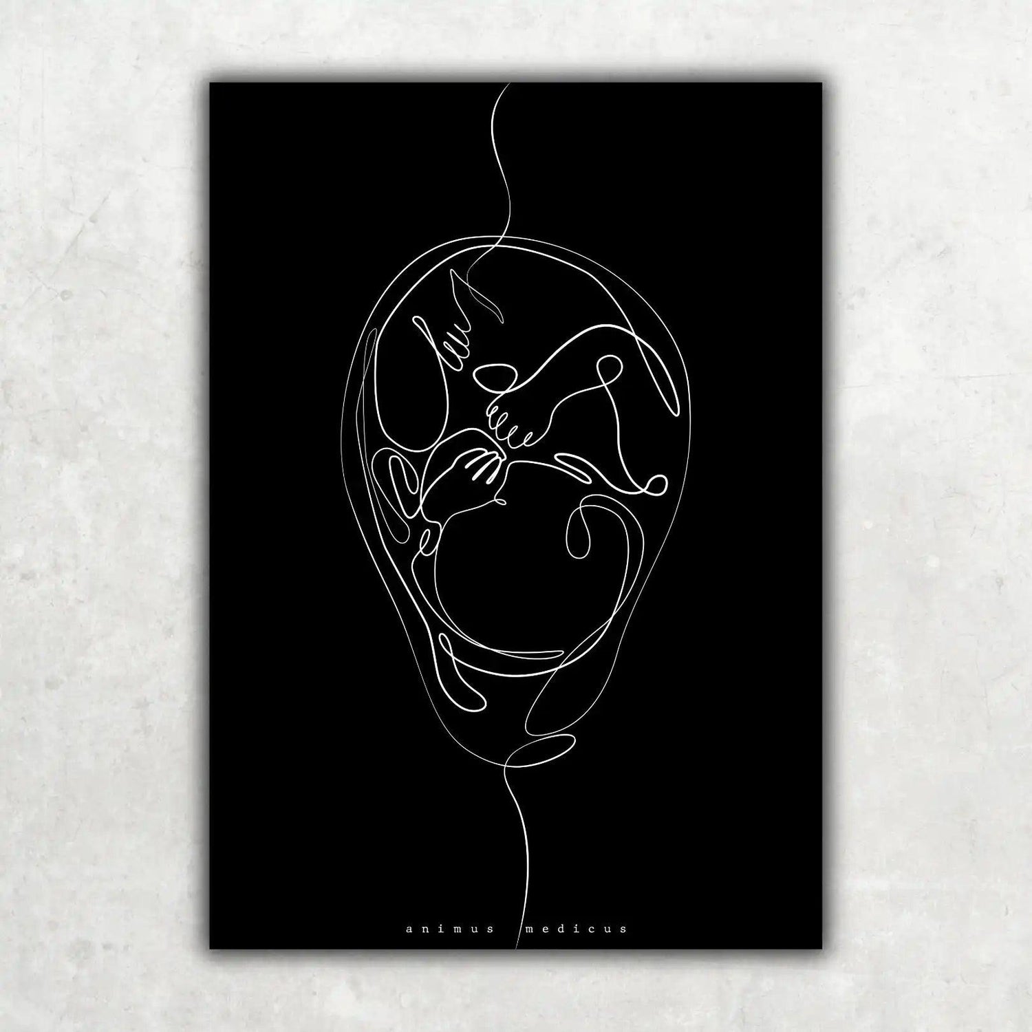 Fetus Anatomie Minimalist Dark - Animus Medicus GmbH
