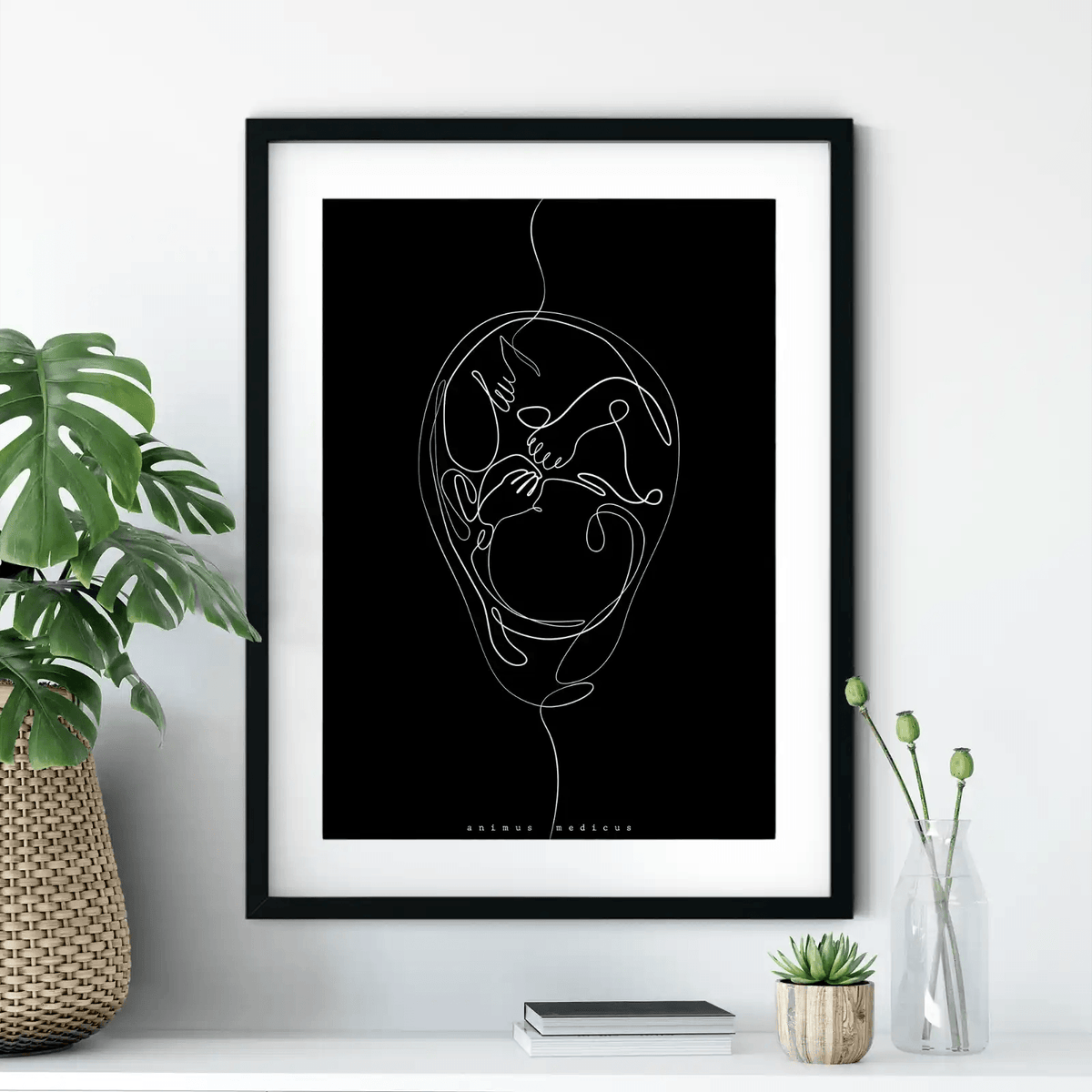 Fetus Anatomie Minimalist Dark - Animus Medicus GmbH