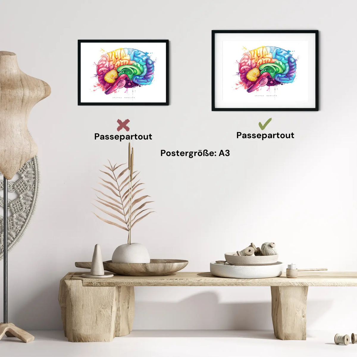 Gehirn Anatomie - Rainbow - Animus Medicus GmbH