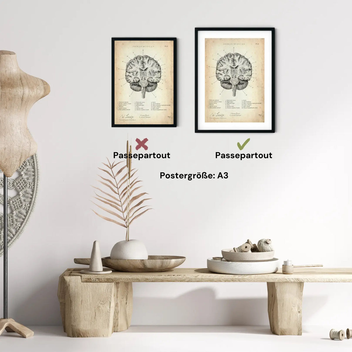 Gehirn Aufbau im Schnitt - Animus Medicus GmbH