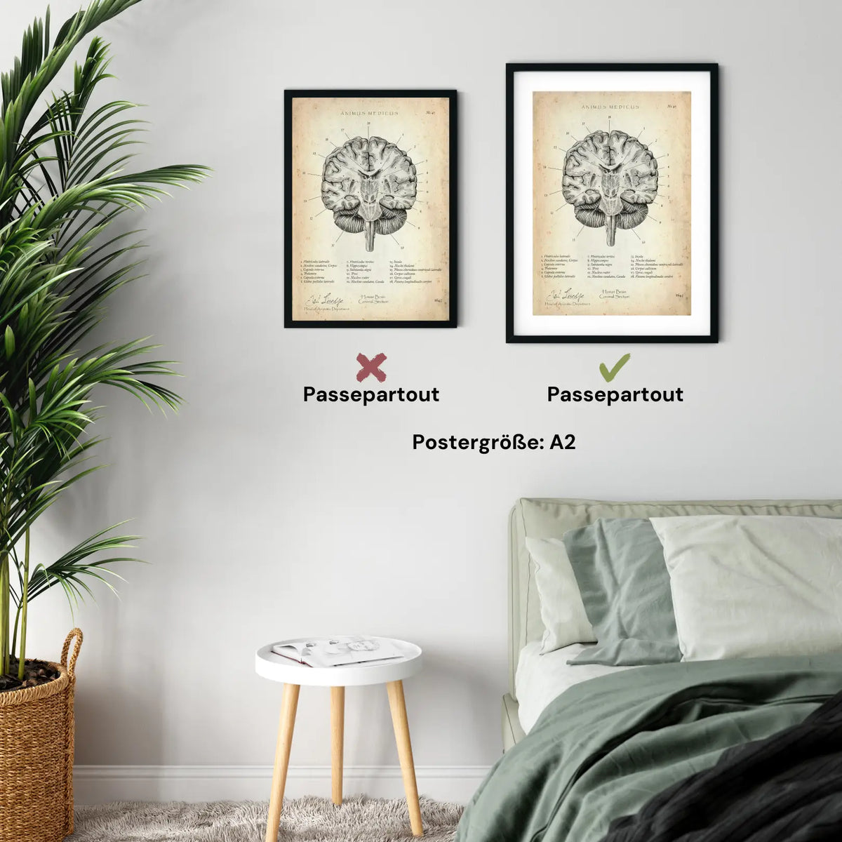 Gehirn Aufbau im Schnitt - Animus Medicus GmbH