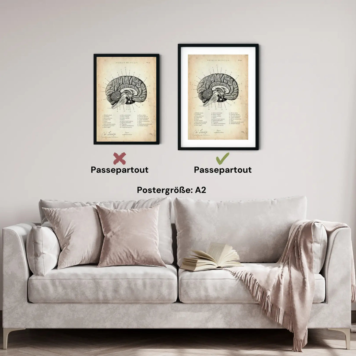 Gehirn im Sagittalschnitt - Animus Medicus GmbH