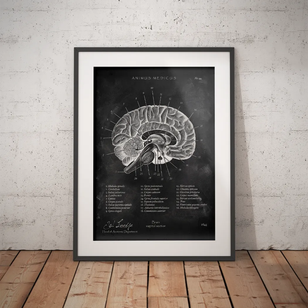 Gehirn im Sagittalschnitt - Chalkboard - Animus Medicus GmbH