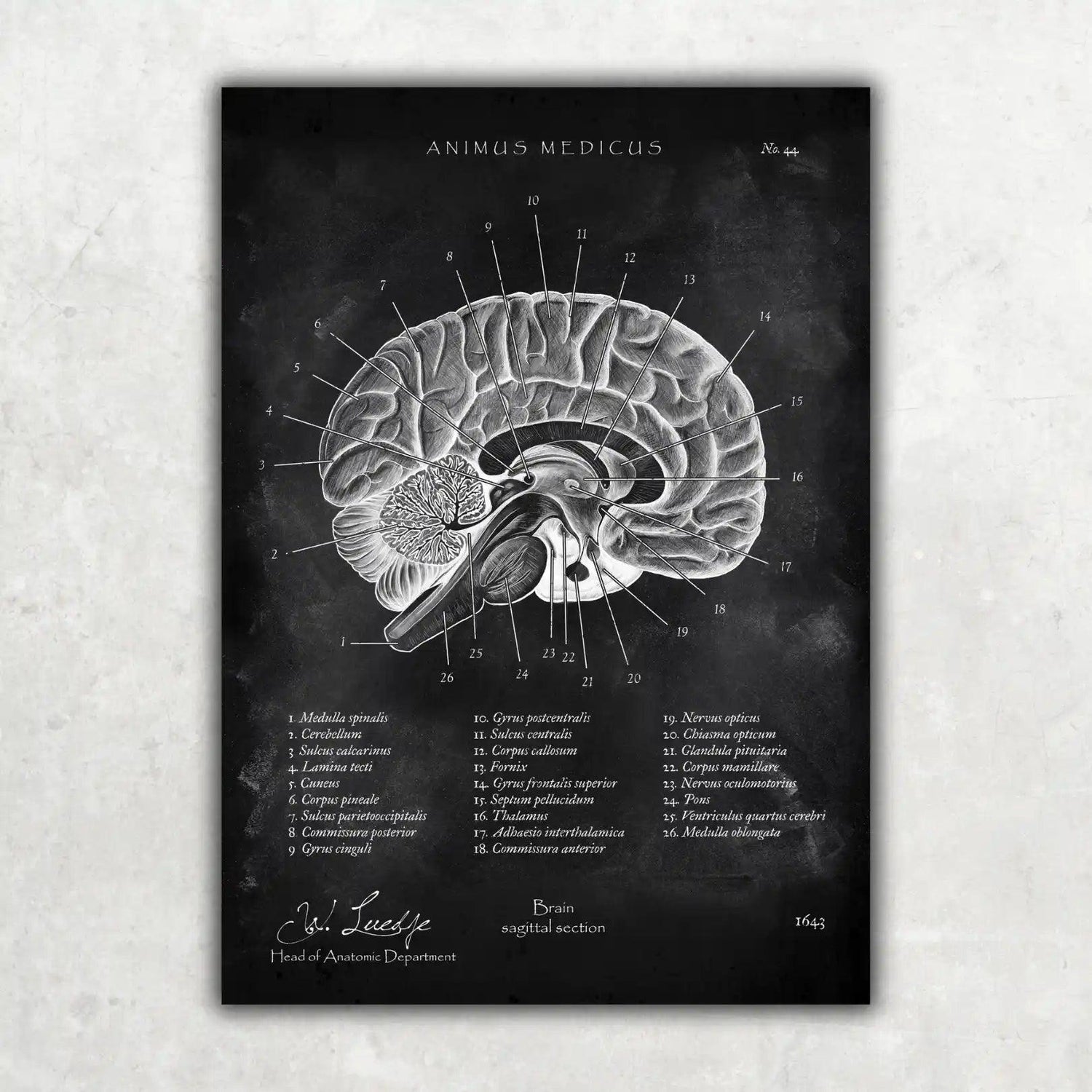 Gehirn im Sagittalschnitt - Chalkboard - Animus Medicus GmbH