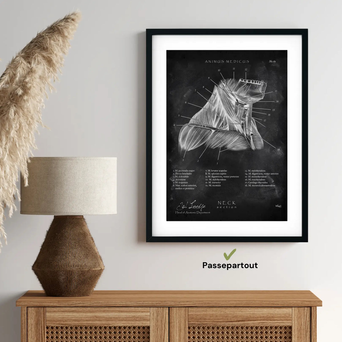 Halsmuskeln im Schnitt - Chalkboard - Animus Medicus GmbH