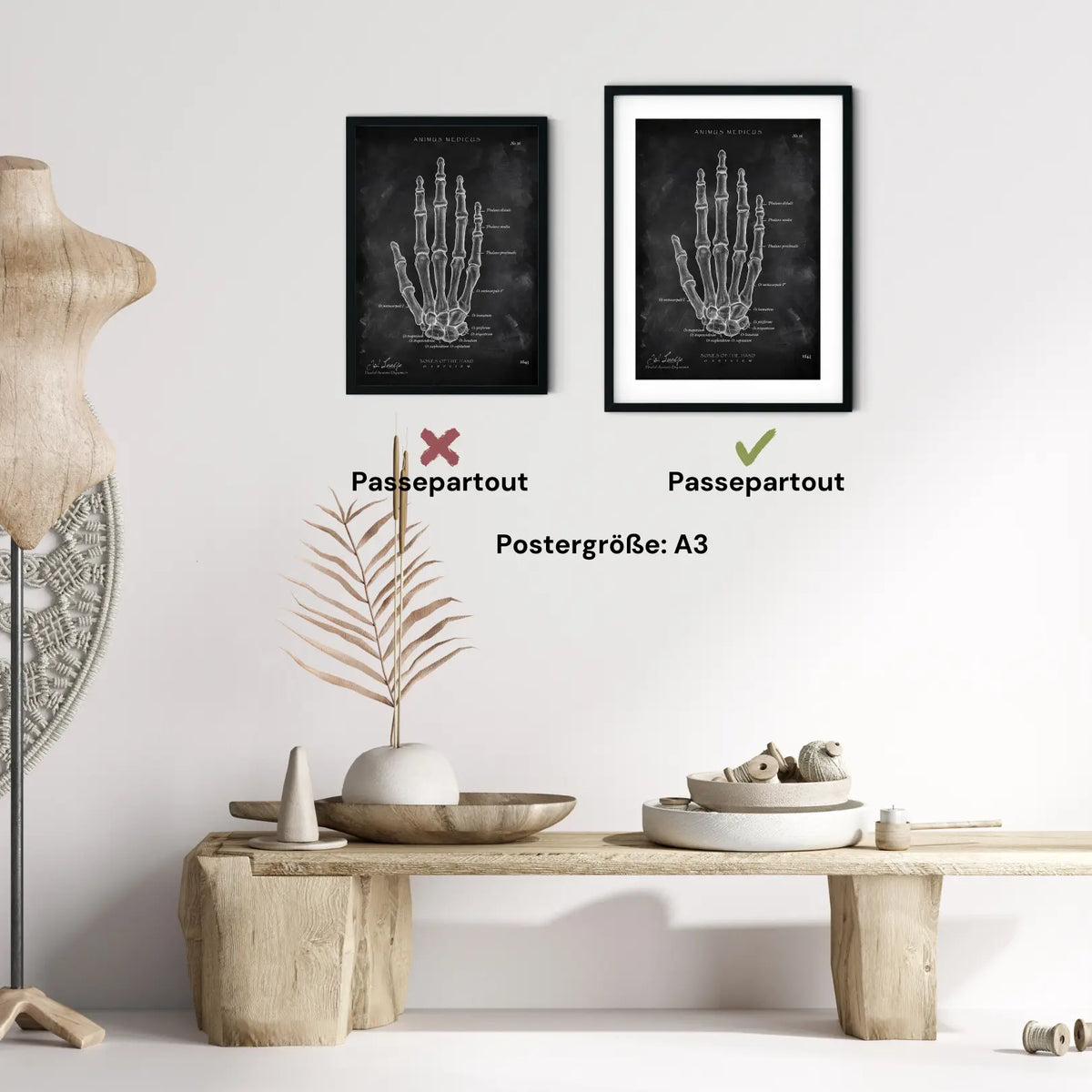 Handknochen Anatomie - Chalkboard - Animus Medicus GmbH
