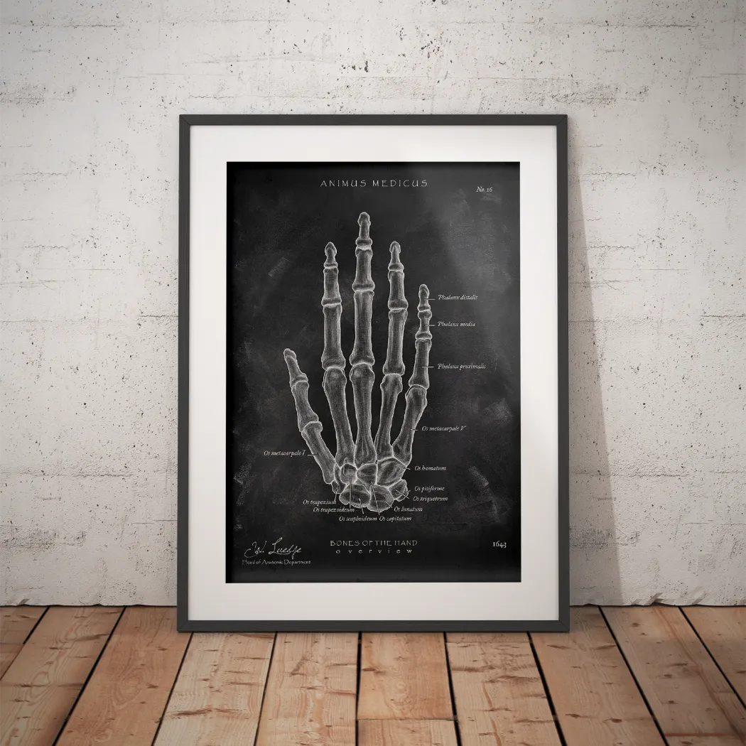 Handknochen Anatomie - Chalkboard - Animus Medicus GmbH