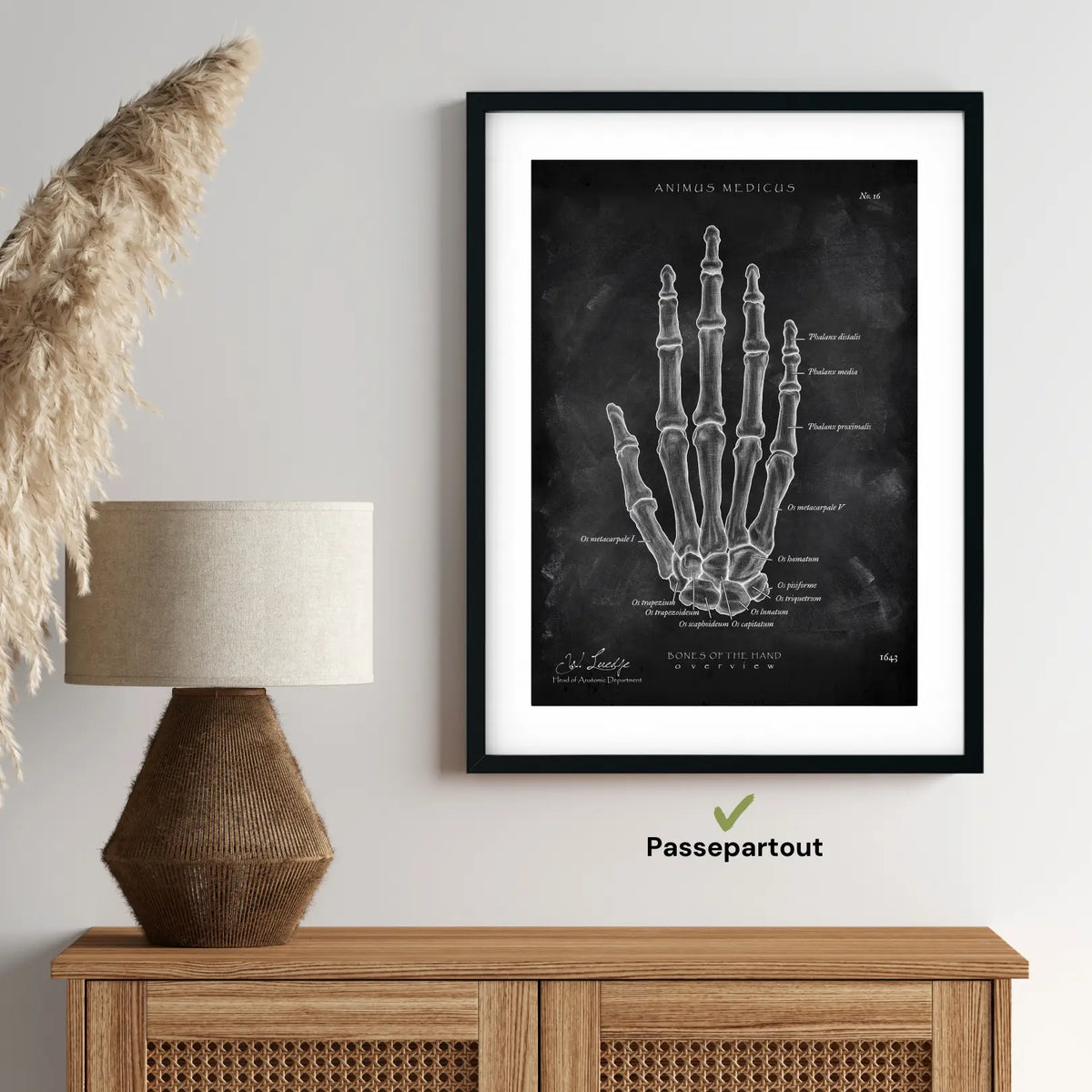 Handknochen Anatomie - Chalkboard - Animus Medicus GmbH