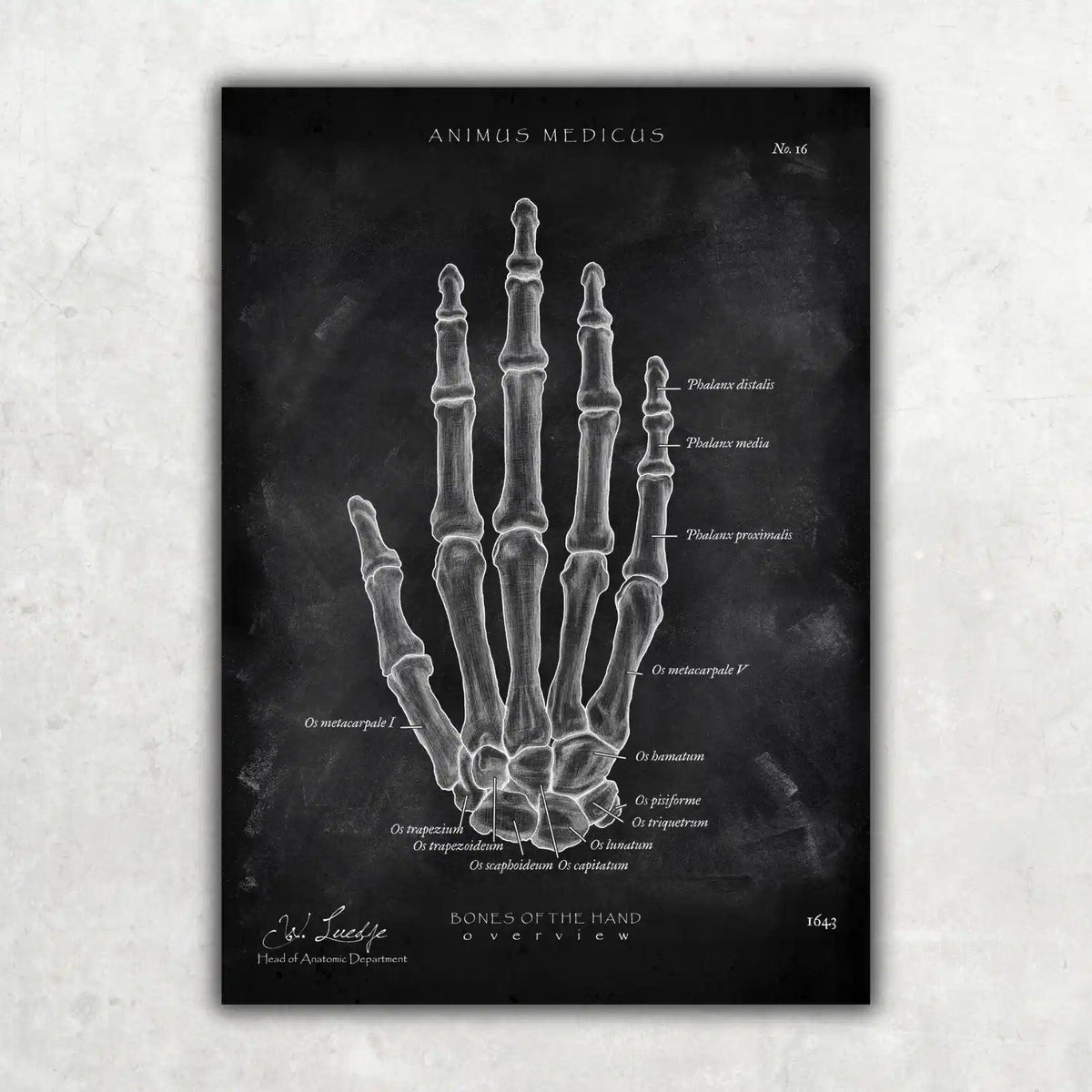 Handknochen Anatomie - Chalkboard - Animus Medicus GmbH