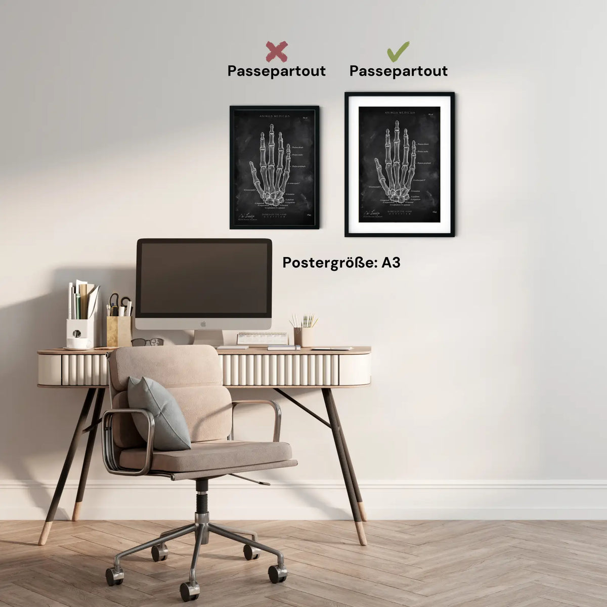 Handknochen Anatomie - Chalkboard - Animus Medicus GmbH