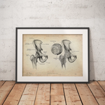 Hüftarthrose - Animus Medicus GmbH