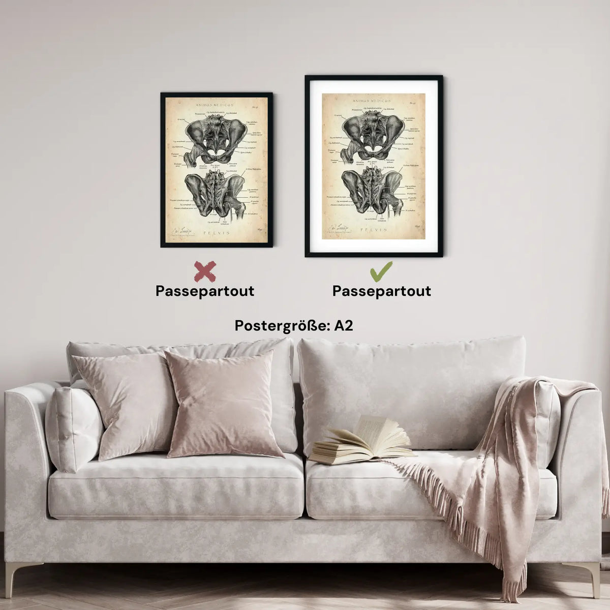 Hüftgelenk Anatomie - Animus Medicus GmbH