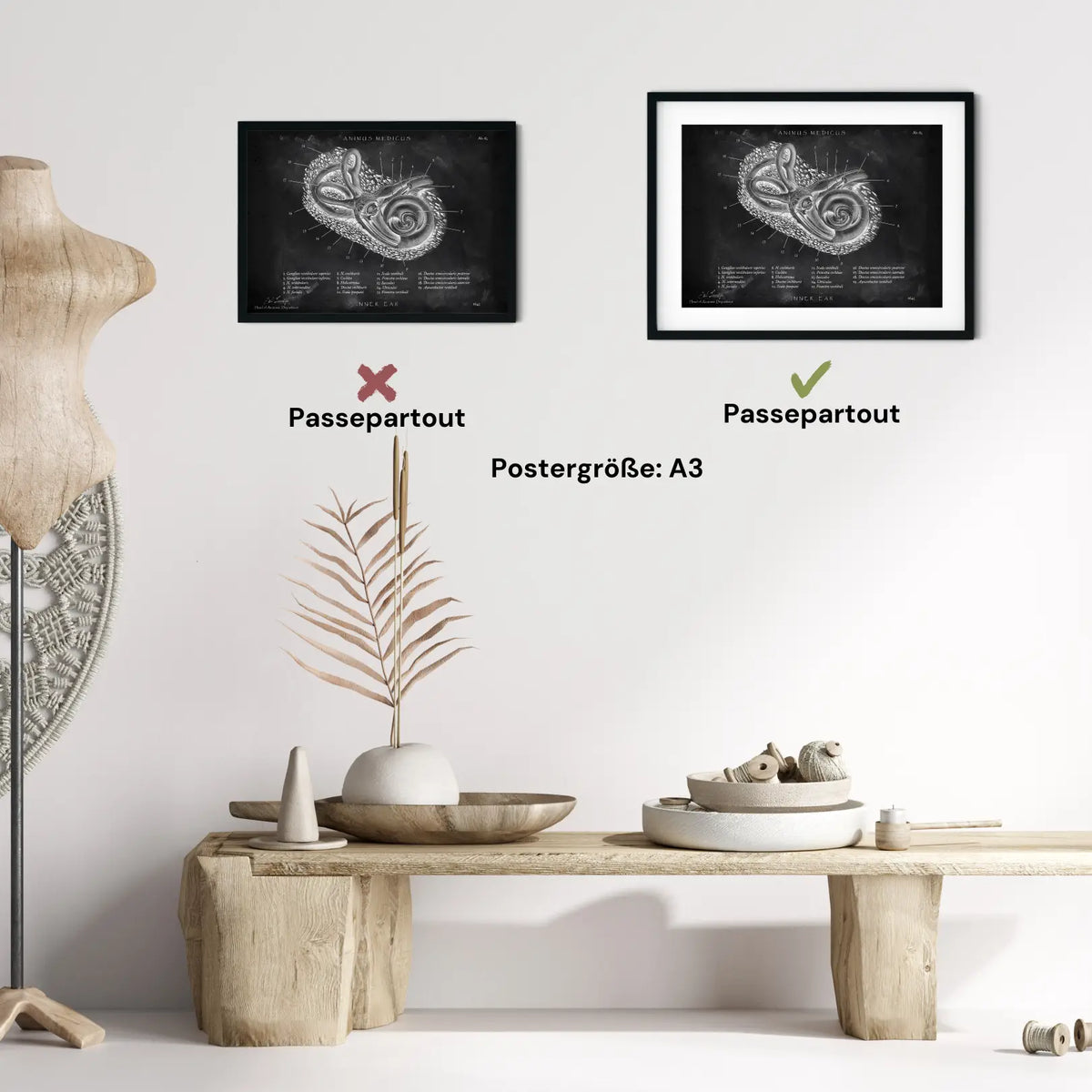 Innenohr Anatomie - Chalkboard - Animus Medicus GmbH