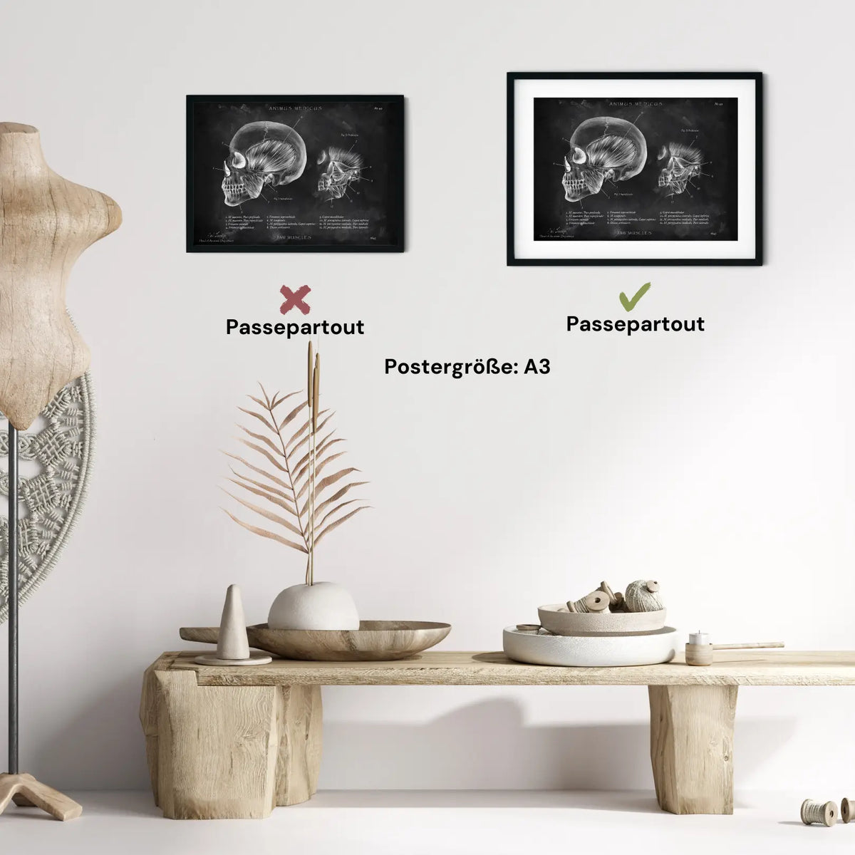 Kaumuskulatur Anatomie - Chalkboard - Animus Medicus GmbH