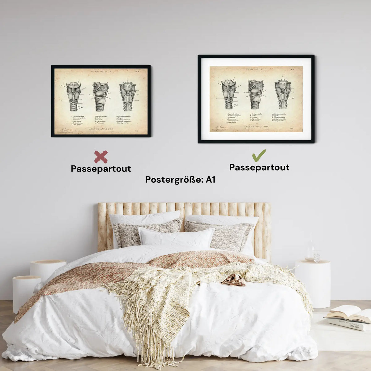 Kehlkopf Anatomie - Animus Medicus GmbH