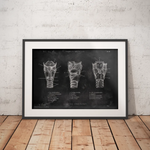 Kehlkopf Anatomie - Chalkboard - Animus Medicus GmbH