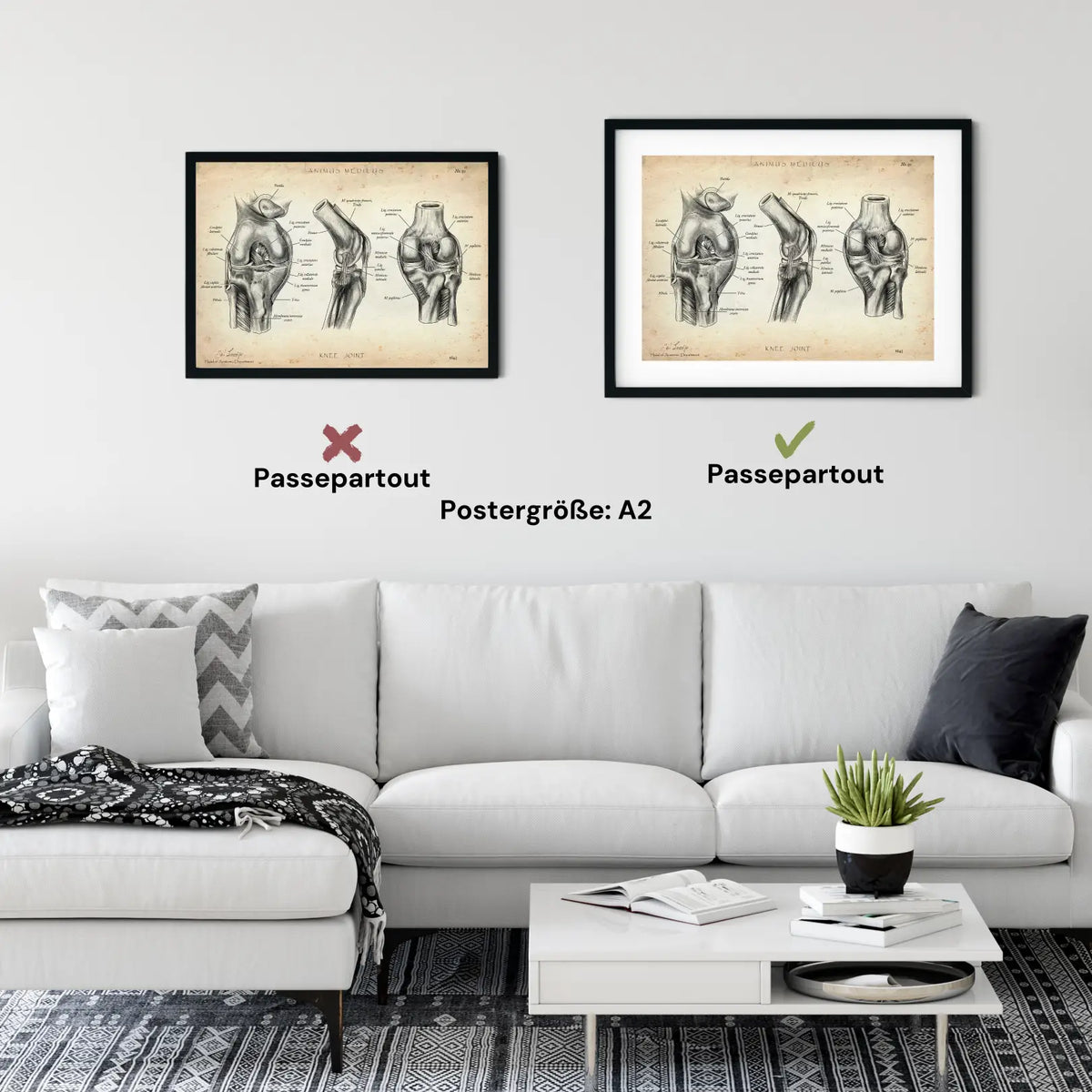 Kniegelenk Anatomie - Animus Medicus GmbH