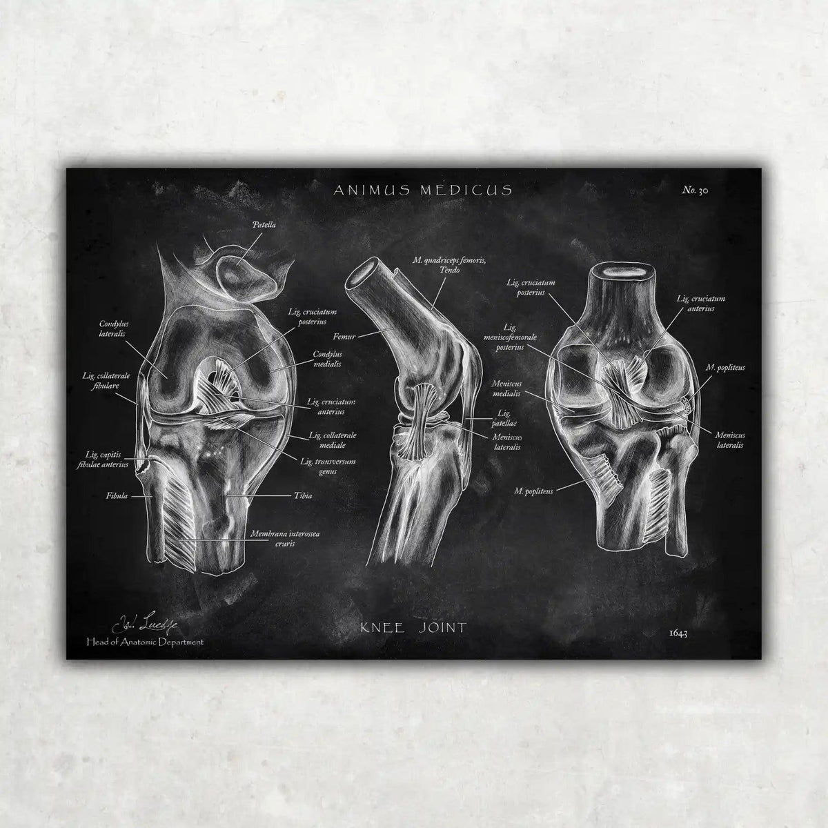 Kniegelenk Anatomie - Chalkboard - Animus Medicus GmbH