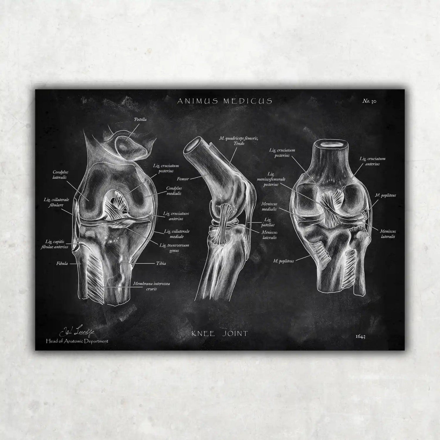 Kniegelenk Anatomie - Chalkboard - Animus Medicus GmbH