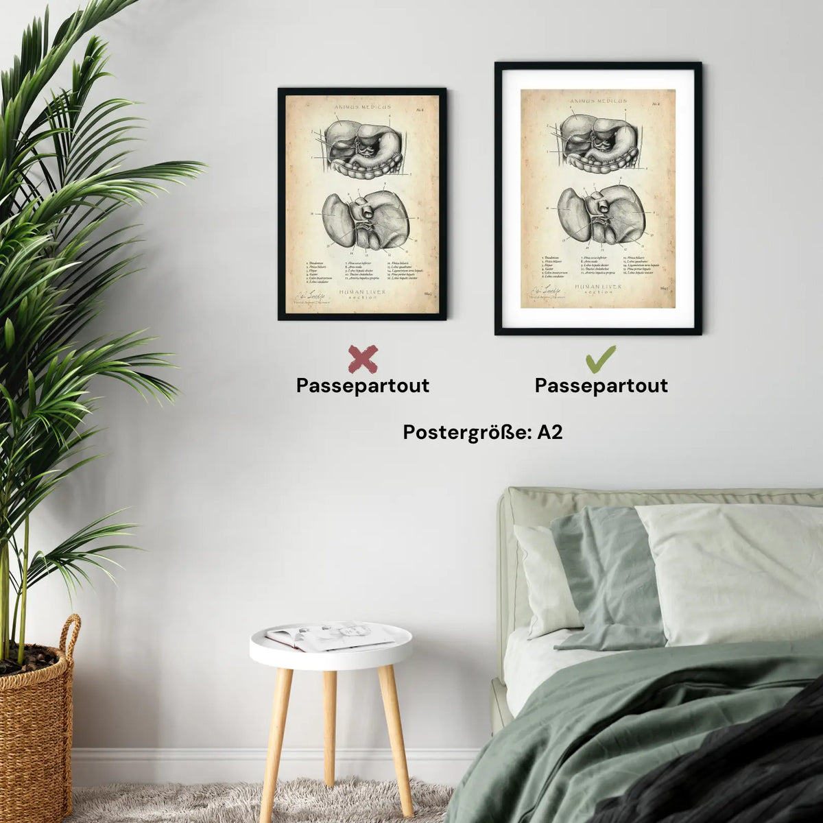 Leber Anatomie - Animus Medicus GmbH