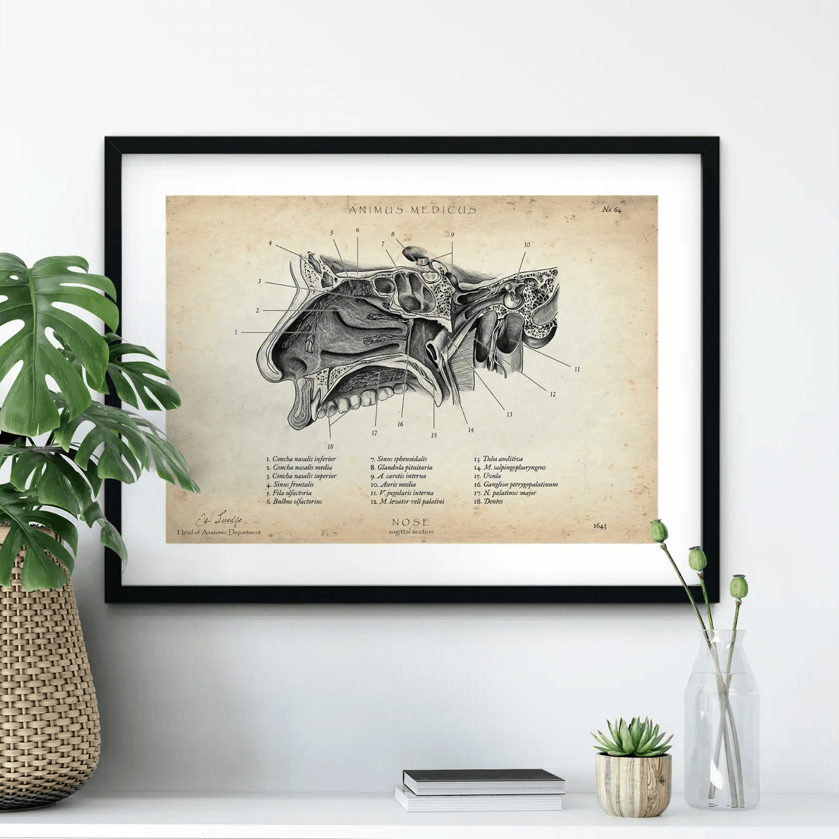 Nase im Sagittalschnitt - Animus Medicus GmbH