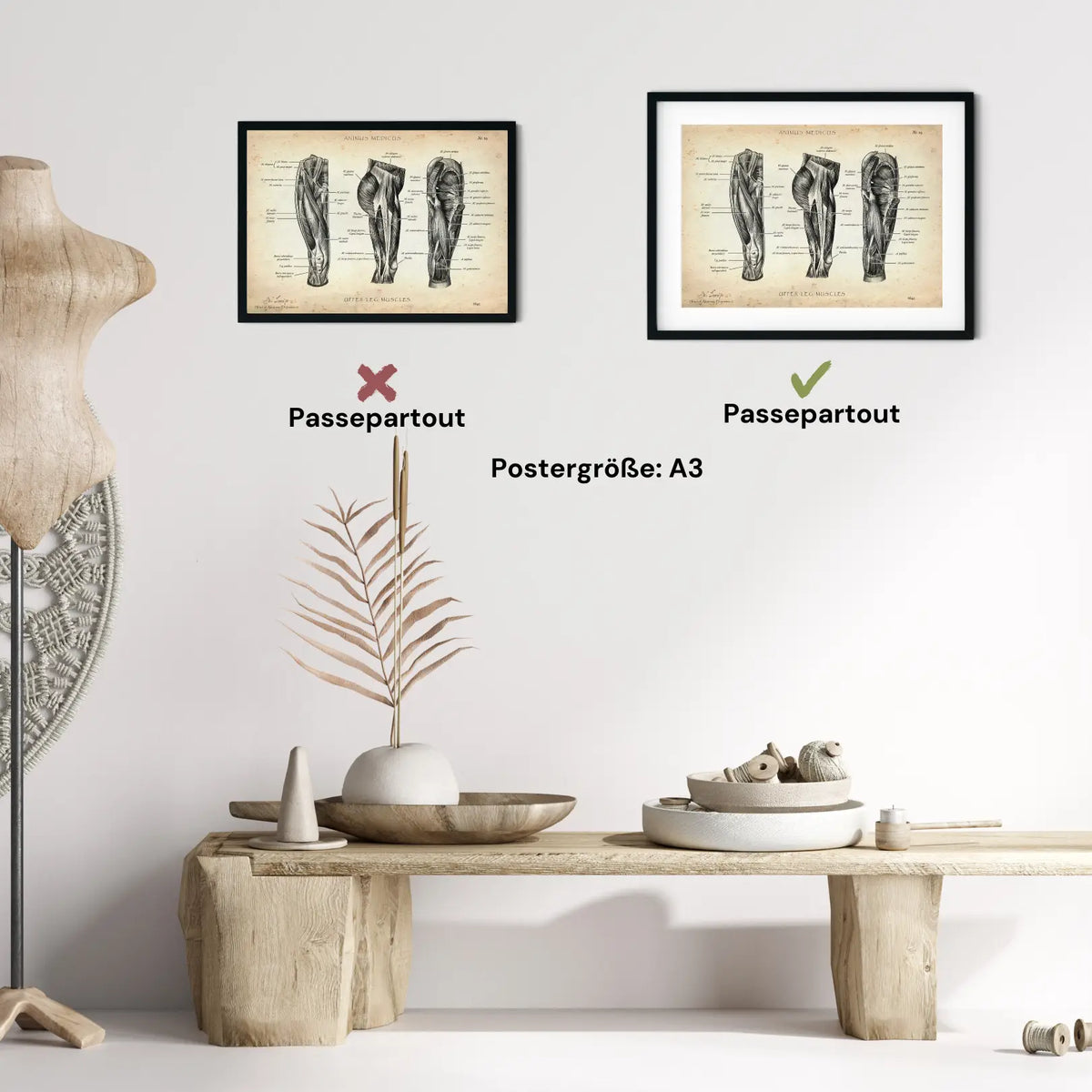 Oberschenkel Muskeln - Animus Medicus GmbH