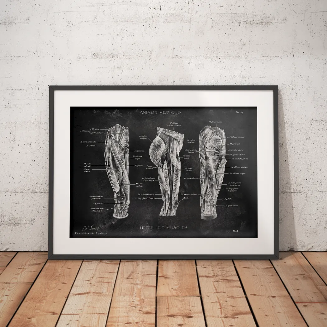 Oberschenkel Muskeln - Chalkboard - Animus Medicus GmbH