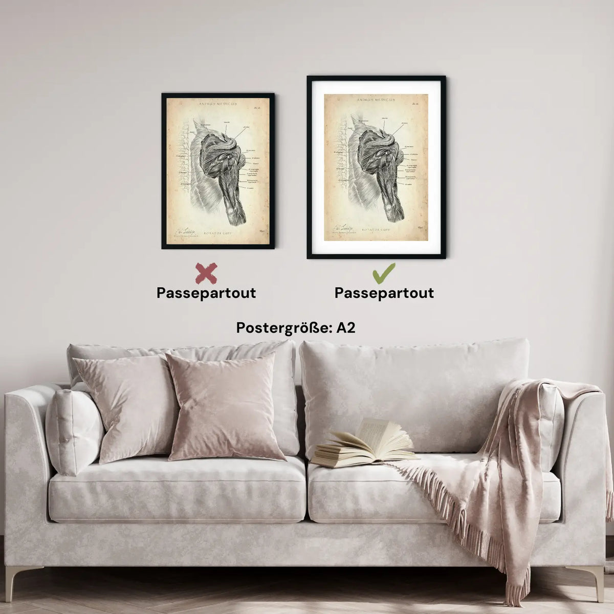 Rotatorenmanschette Anatomie - Animus Medicus GmbH