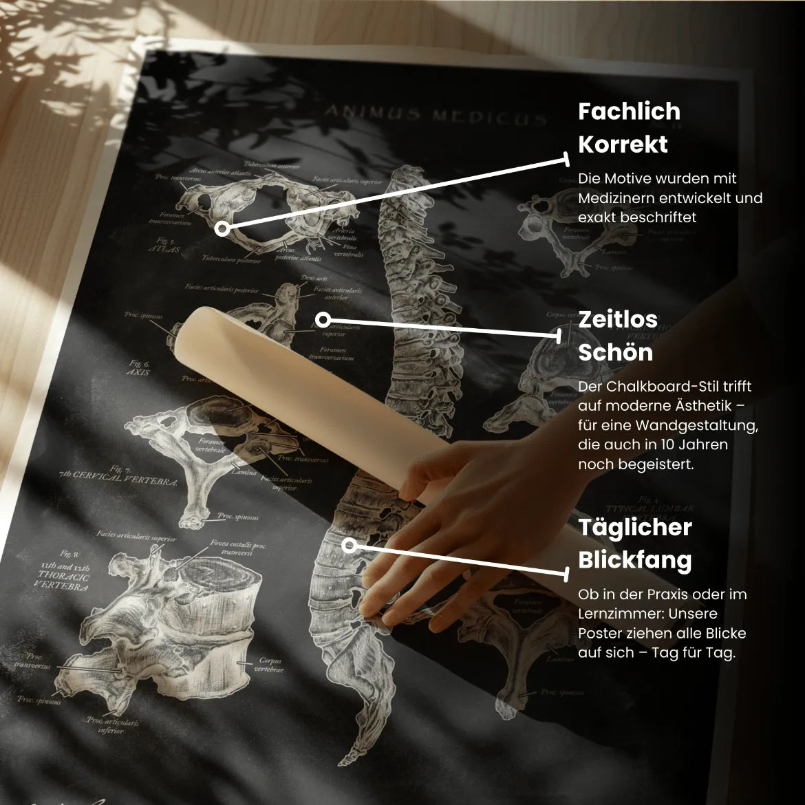 Rücken Anatomie Sammlung - Chalkboard - Animus Medicus GmbH