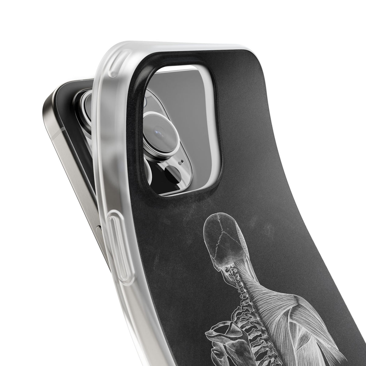 Rücken - Chalkboard - Animus Medicus GmbH