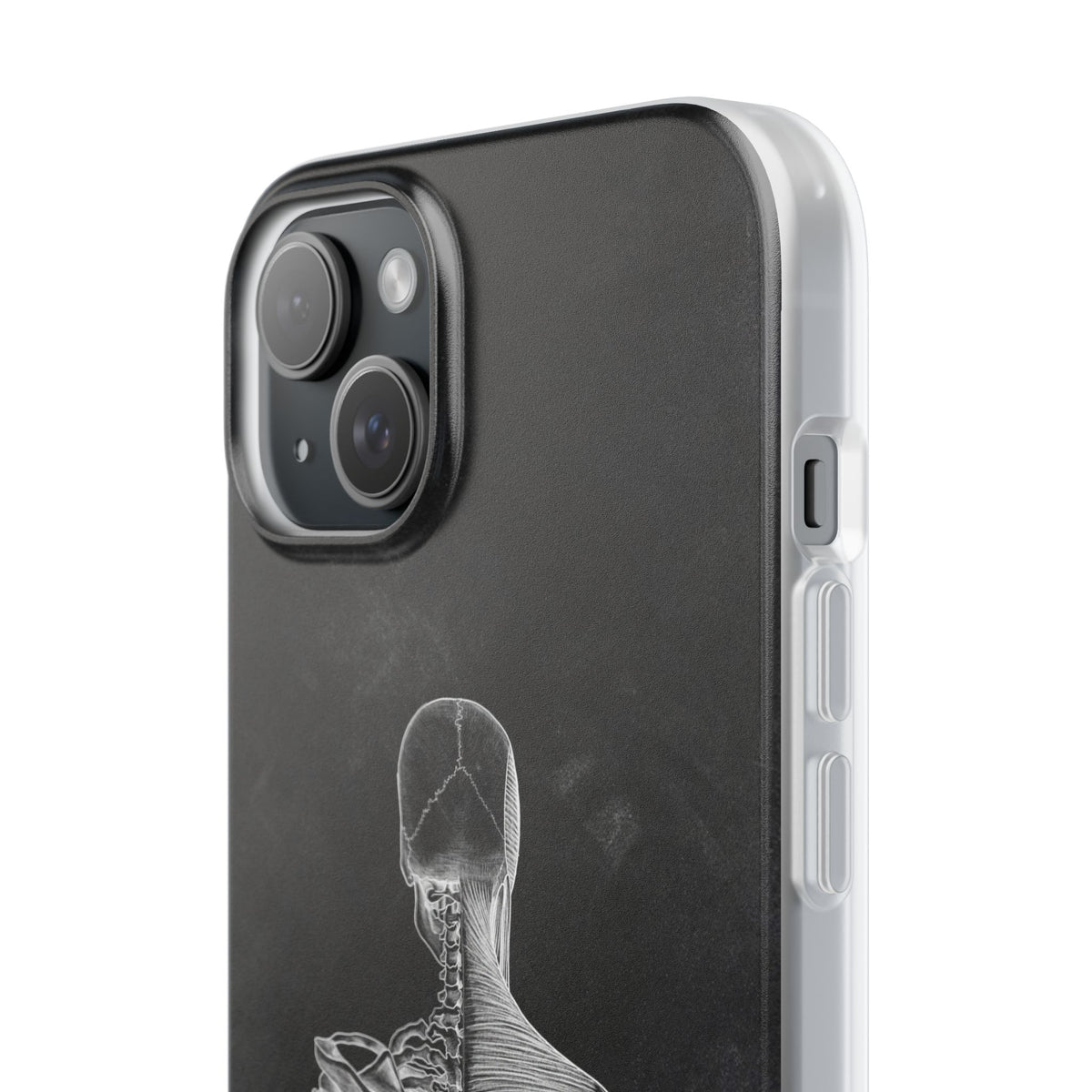 Rücken - Chalkboard - Animus Medicus GmbH