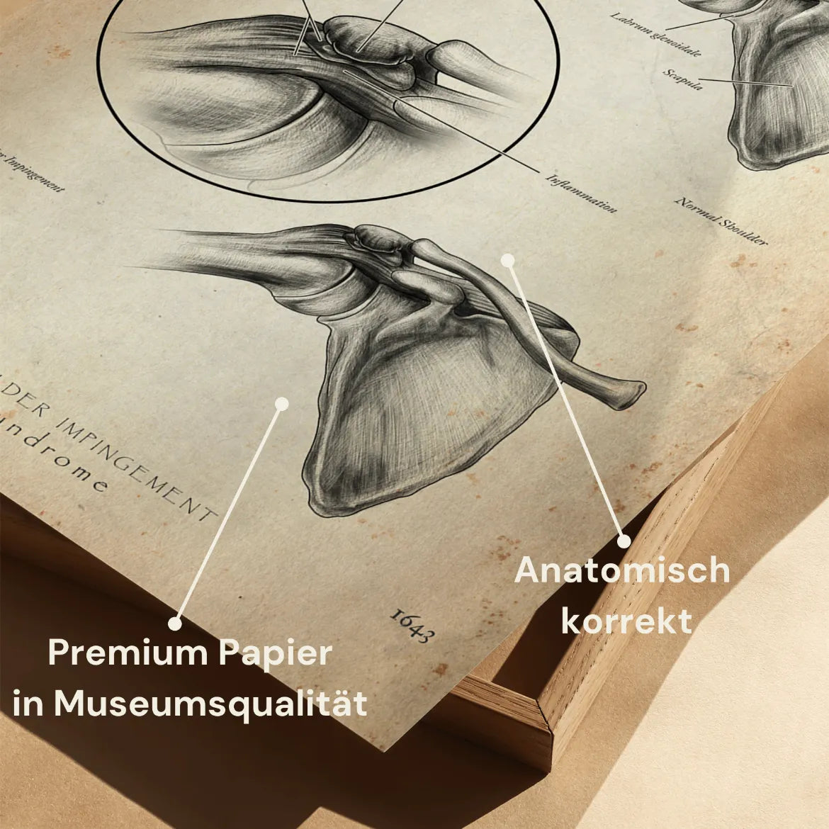 Schulter Impingement - Animus Medicus GmbH