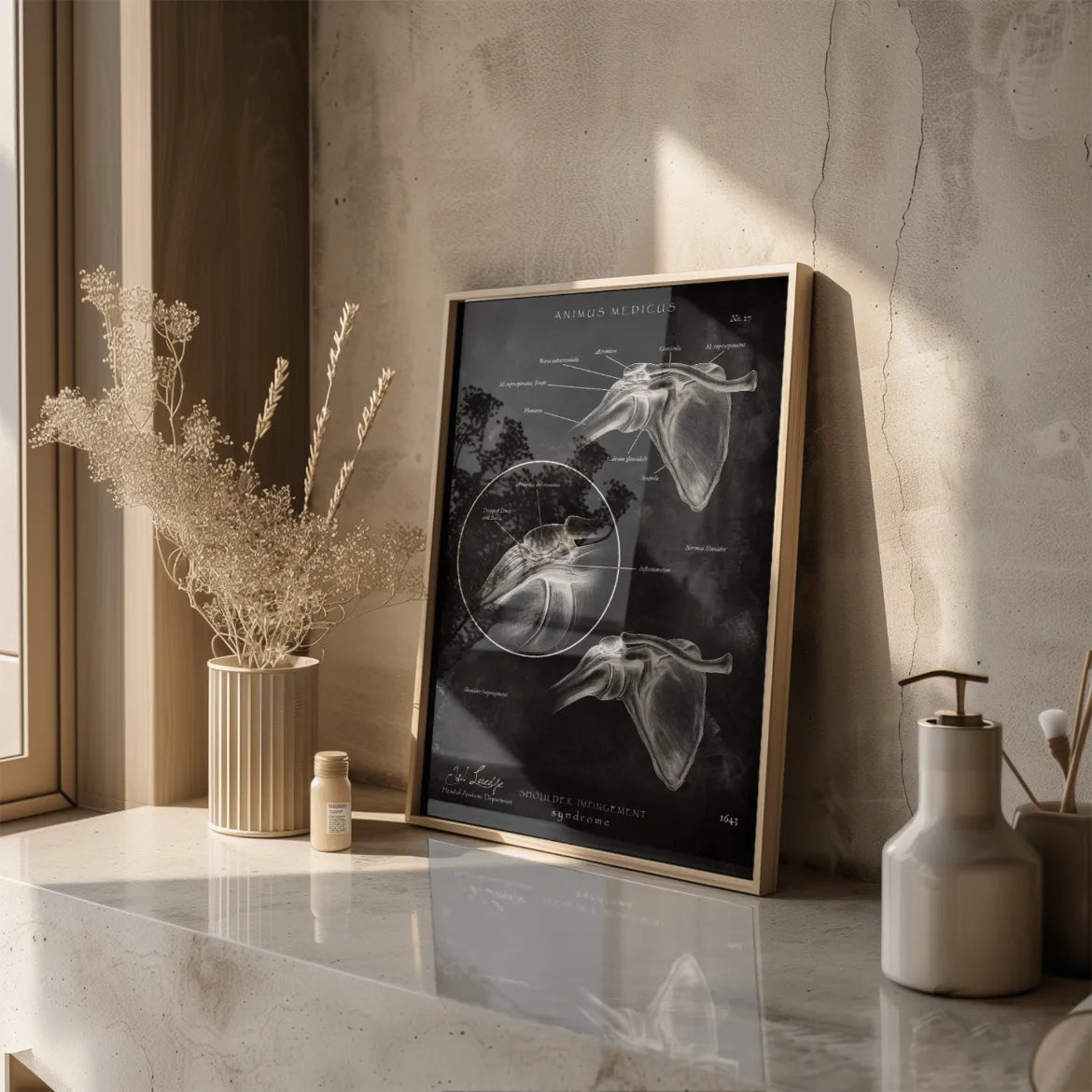 Schulter Impingement - Chalkboard - Animus Medicus GmbH