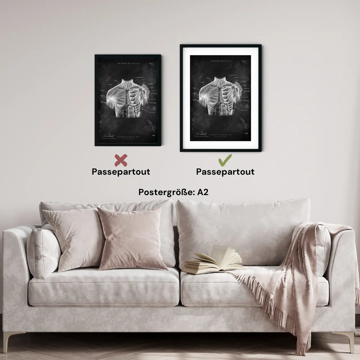 Schulter Muskulatur - Chalkboard - Animus Medicus GmbH