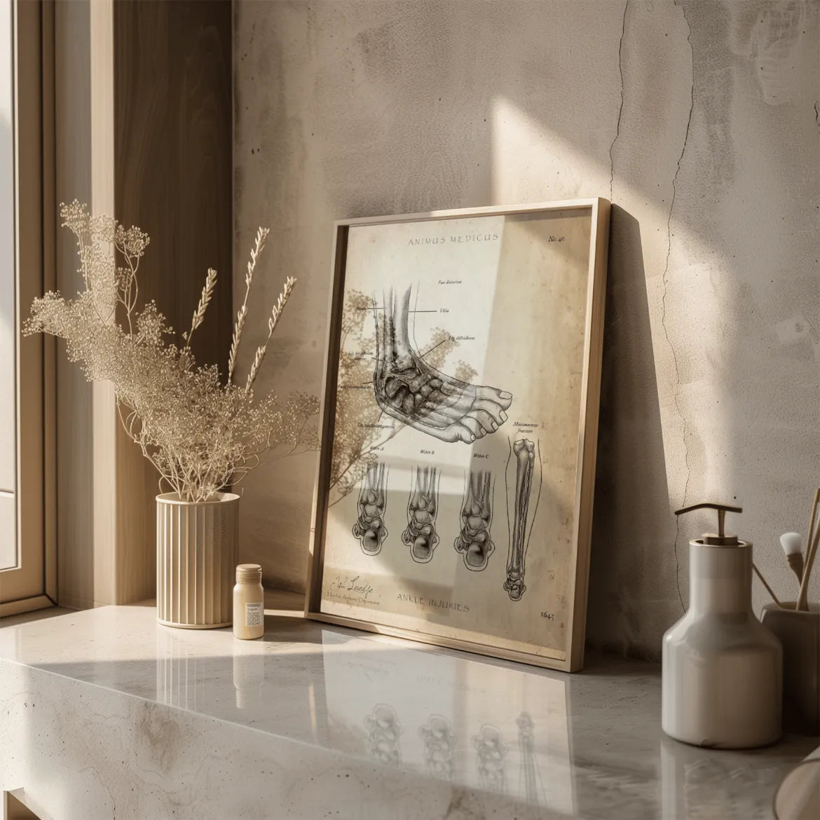 Sprunggelenk mit Bänderriss - Animus Medicus GmbH