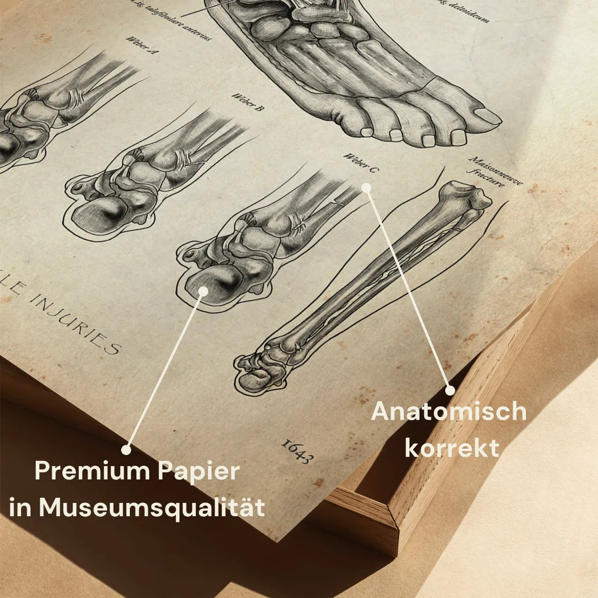 Sprunggelenk mit Bänderriss - Animus Medicus GmbH
