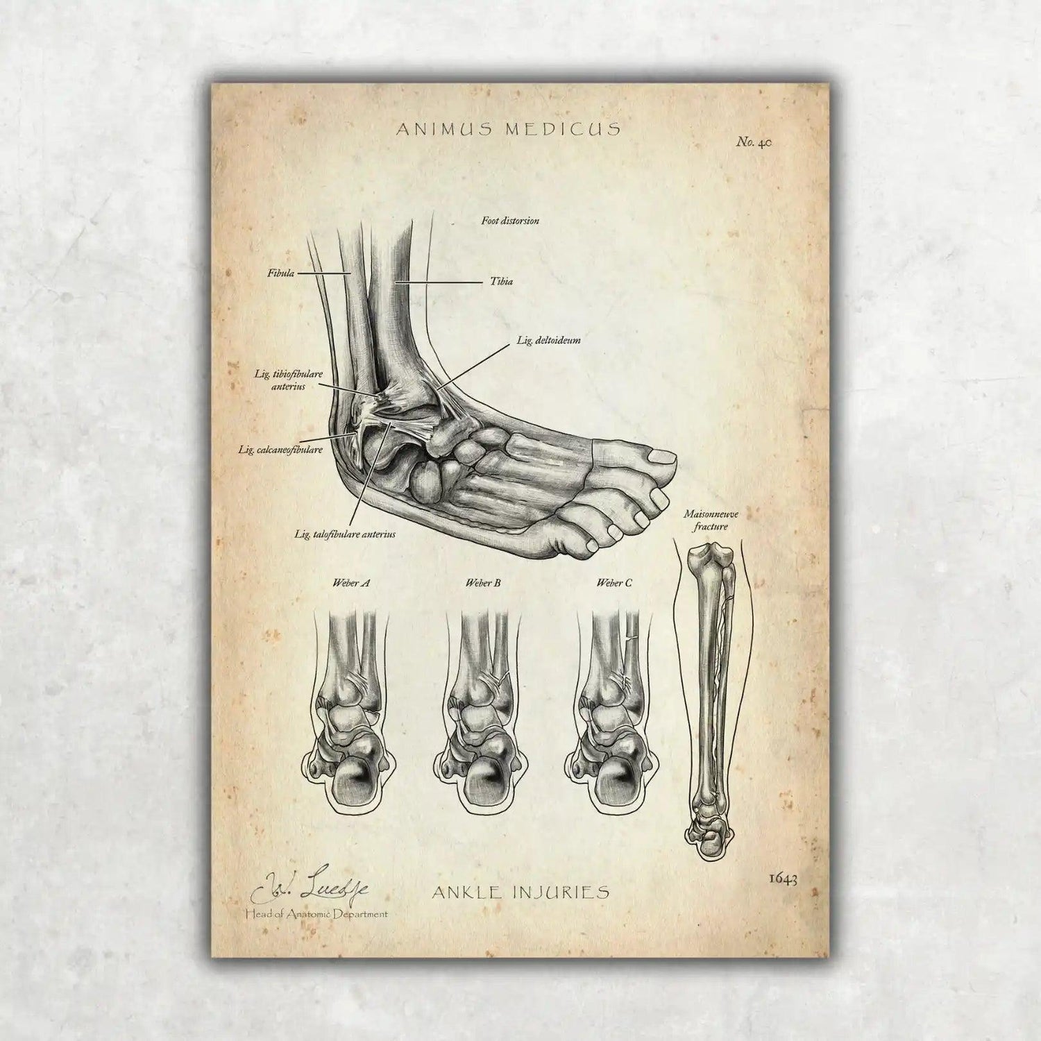Sprunggelenk mit Bänderriss - Animus Medicus GmbH