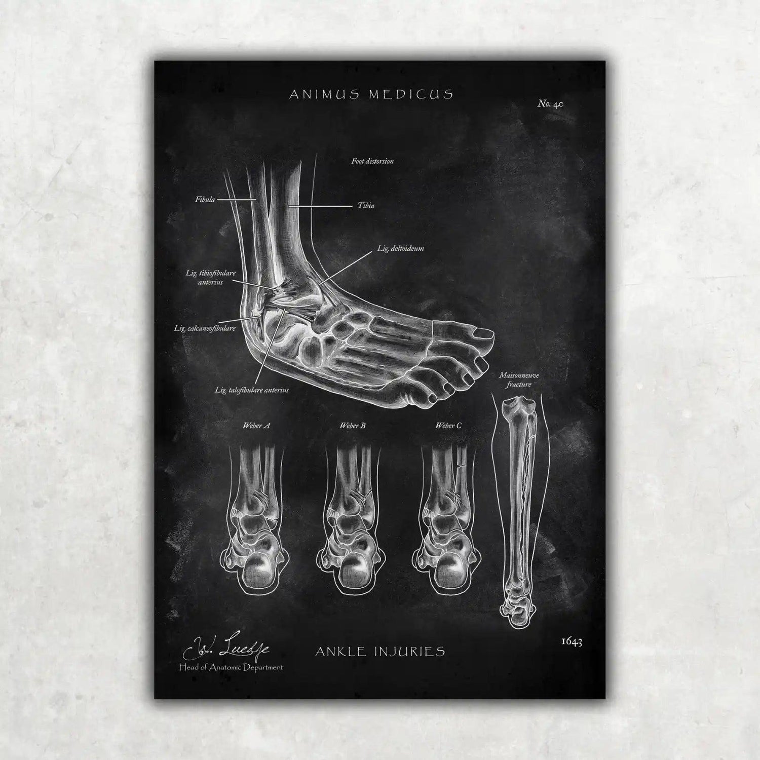 Sprunggelenk mit Bänderriss - Chalkboard - Animus Medicus GmbH